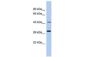 C11ORF46 antibody used at 1 ug/ml to detect target protein. (C11orf46 anticorps  (N-Term))
