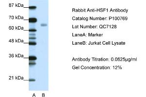 WB Suggested Anti-HSF1  Antibody Titration: 0. (HSF1 anticorps  (C-Term))