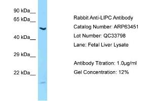 Western Blotting (WB) image for anti-Lipase, Hepatic (LIPC) (C-Term) antibody (ABIN2789506) (LIPC anticorps  (C-Term))