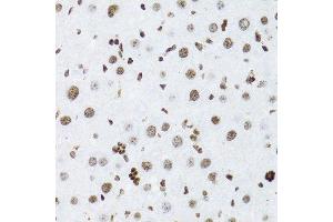 Immunohistochemistry of paraffin-embedded rat liver using NFKB2 Antibody.