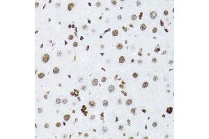 Immunohistochemistry of paraffin-embedded rat liver using NFKB2 Antibody. (NFKB2 anticorps  (AA 690-899))