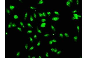 Immunofluorescence staining of Hela cells with ABIN7147315 at 1:166, counter-stained with DAPI.