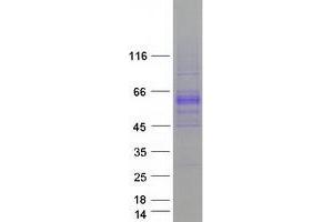 Validation with Western Blot