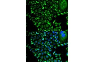 Immunofluorescence analysis of HeLa cell using PSMD10 antibody.