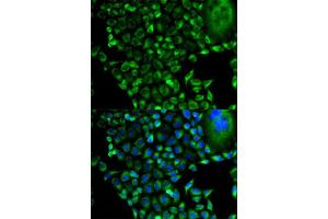 Immunofluorescence analysis of HeLa cell using PSMD10 antibody. (PSMD10 anticorps  (AA 1-226))