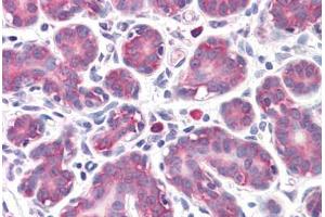 Human Breast: Formalin-Fixed, Paraffin-Embedded (FFPE)