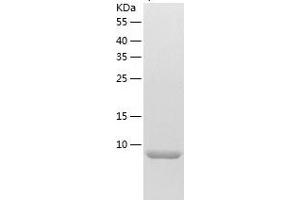 Western Blotting (WB) image for Tumor Necrosis Factor Receptor Superfamily, Member 12A (TNFRSF12A) (AA 28-80) protein (His-IF2DI Tag) (ABIN7125548)