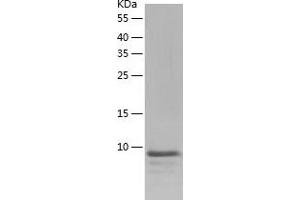 Western Blotting (WB) image for Family with Sequence Similarity 19 (Chemokine (C-C Motif)-Like), Member A2 (FAM19A2) (AA 31-131) protein (His-IF2DI Tag) (ABIN7122876)