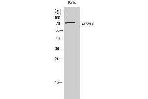 Western Blotting (WB) image for anti-Solute Carrier Family 27 (Fatty Acid Transporter), Member 5 (SLC27A5) (Internal Region) antibody (ABIN6287283)