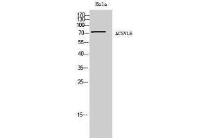 Western Blotting (WB) image for anti-Solute Carrier Family 27 (Fatty Acid Transporter), Member 5 (SLC27A5) (Internal Region) antibody (ABIN3183156) (SLC27A5 anticorps  (Internal Region))