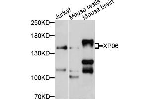 Western blot analysis of extracts of various cell lines, using XPO6 antibody (ABIN4905638) at 1:1000 dilution. (Exportin 6 anticorps)