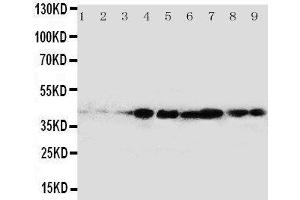 Western Blotting (WB) image for anti-V-Crk Sarcoma Virus CT10 Oncogene Homolog (Avian)-Like (CRKL) (AA 286-303), (C-Term) antibody (ABIN3043046)