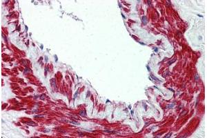 Anti-TRPM8 antibody  ABIN960829 IHC staining of human lung, vessel. (TRPM8 anticorps  (N-Term))