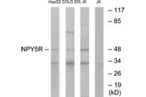 Western blot analysis of extracts from COLO/Jurkat/HepG2 cells, using NPY5R Antibody. (NPY5R anticorps  (AA 221-270))