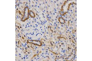 Immunohistochemistry of paraffin-embedded rat kidney tissue using PIBF1 antibody at dilution of 1:200 (x400 lens). (PIBF1 anticorps)