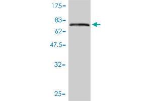 Western Blot detection against Immunogen (73. (KRT17 anticorps  (AA 1-432))