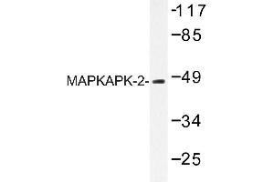 Image no. 1 for anti-Mitogen-Activated Protein Kinase-Activated Protein Kinase 2 (MAPKAPK2) antibody (ABIN272118) (MAPKAP Kinase 2 anticorps)
