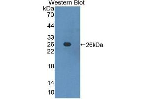 Western Blotting (WB) image for anti-Suppressor of Cytokine Signaling 3 (SOCS3) (AA 1-225) antibody (ABIN1078552) (SOCS3 anticorps  (AA 1-225))