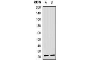 Western blot analysis of ASF1B expression in Jurkat (A), Hela (B) whole cell lysates. (ASF1B anticorps)