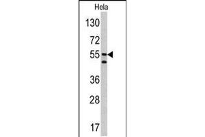 Western blot analysis of CA9 antibody in Hela cell line lysates (35ug/lane) (CA9 anticorps  (AA 113-143))