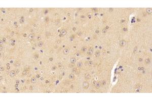 Detection of CORT in Mouse Cerebrum Tissue using Polyclonal Antibody to Carnitine-O-Octanoyltransferase (CORT)
