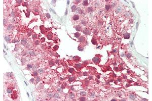 Rabbit Anti-RUVBL2 antibody  Formalin Fixed Paraffin Embedded Tissue: Human Testis Primary antibody Concentration: 1:100 Secondary Antibody: Donkey anti-Rabbit-Cy3 Secondary Antibody Concentration: 1:200 Magnification: 20x Exposure Time: 0.