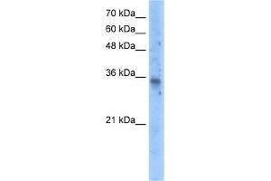 WB Suggested Anti-SLC25A16 Antibody Titration:  5. (SLC25A16 anticorps  (N-Term))