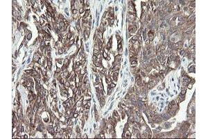 Image no. 2 for anti-Prefoldin Subunit 3 (PFDN3) antibody (ABIN1501702)