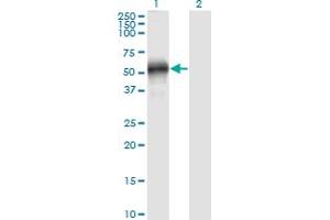 Western Blot analysis of EFEMP2 expression in transfected 293T cell line by EFEMP2 monoclonal antibody (M01), clone 2C8.
