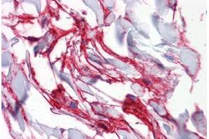 Human Colon, connective tissue: Formalin-Fixed, Paraffin-Embedded (FFPE) (Aquaporin 8 anticorps  (AA 1-255))