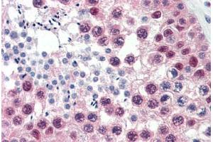 Human Testis (formalin-fixed, paraffin-embedded) stained with CUL1 antibody ABIN337174 at 10 ug/ml followed by biotinylated anti-mouse IgG secondary antibody ABIN481714, alkaline phosphatase-streptavidin and chromogen.