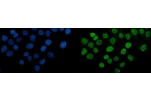 IF analysis of PARP using anti-PARP antibody (ABIN7602278). (PARP1 anticorps  (AA 670-858))