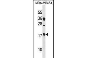 SIT1 Antibody (C-term) (ABIN1536758 and ABIN2848480) western blot analysis in MDA-M cell line lysates (35 μg/lane). (SIT1 anticorps  (C-Term))