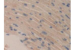 Detection of DLD in Mouse Heart Tissue using Polyclonal Antibody to Dihydrolipoyl Dehydrogenase (DLD) (DLD anticorps  (AA 45-271))