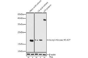 Western blot analysis of extracts of various cell lines, using Acetyl-Histone H3-K27 antibody (ABIN7267738) at 1:1000 dilution. (Histone H4 anticorps  (H3K27))