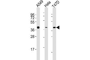 All lanes : Anti-ERCC1 Antibody (C-term) at 1:2000 dilution Lane 1: A549 whole cell lysates Lane 2: Hela whole cell lysates Lane 3: T47D whole cell lysates Lysates/proteins at 20 μg per lane. (ERCC1 anticorps  (C-Term))