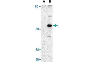 Western blot analysis of AVEN in Raji cell lysate with AVEN polyclonal antibody  at 1 ug/mL in (A) the presence and (B) the absence of blocking peptide. (AVEN anticorps  (C-Term))