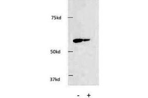 Western blot testing of HDAC1 antibody and HEK293 cells. (HDAC1 anticorps  (AA 449-482))