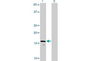 Western Blot analysis of AGTRAP expression in transfected 293T cell line by AGTRAP monoclonal antibody (M02), clone 1G2.