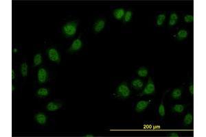 Immunofluorescence of monoclonal antibody to CAND1 on HeLa cell. (CAND1 anticorps  (AA 1-100))