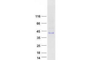 Validation with Western Blot