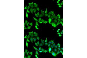 Immunofluorescence analysis of A549 cells using GRK6 antibody. (GRK6 anticorps)