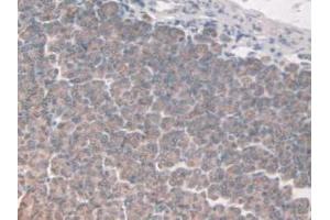 IHC-P analysis of Mouse Stomach Tissue, with DAB staining.