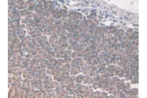 IHC-P analysis of Mouse Stomach Tissue, with DAB staining. (FAP anticorps  (AA 542-761))