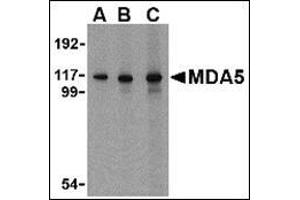 Western blot analysis of MDA5 in Daudi cell lysate with AP30553PU-N MDA5 antibody at 1 µg/ml (A), 2 µg/ml (B) and 4 μg/ml (C). (IFIH1 anticorps  (C-Term))