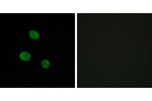 Peptide - +Immunofluorescence analysis of MCF-7 cells, using hnRNP M antibody. (HNRNPM anticorps)
