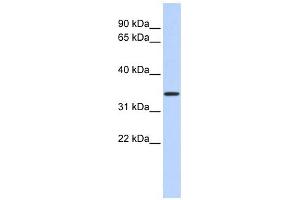 CCDC90A antibody used at 1 ug/ml to detect target protein. (CCDC90A anticorps  (Middle Region))