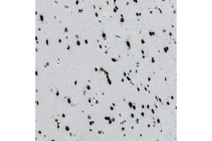 Immunohistochemical staining of human cerebral cortex with TTC13 polyclonal antibody  shows strong nuclear positivity in neurons at 1:20-1:50 dilution. (TTC13 anticorps)
