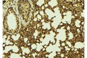 anti-B-Cell CLL/lymphoma 9-Like (BCL9L) (pSer915) antibody