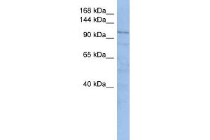 WB Suggested Anti-TRAK1  Antibody Titration: 0. (TRAK1 anticorps  (Middle Region))